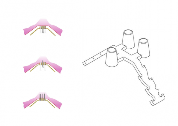 7de2fda3fed6332af9fc4637d5638d93_1472088